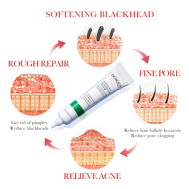 1/2/3pcs BIOAQUA Salicylic Aci - Salicylic Acid Blackhead Remover 评论和价格