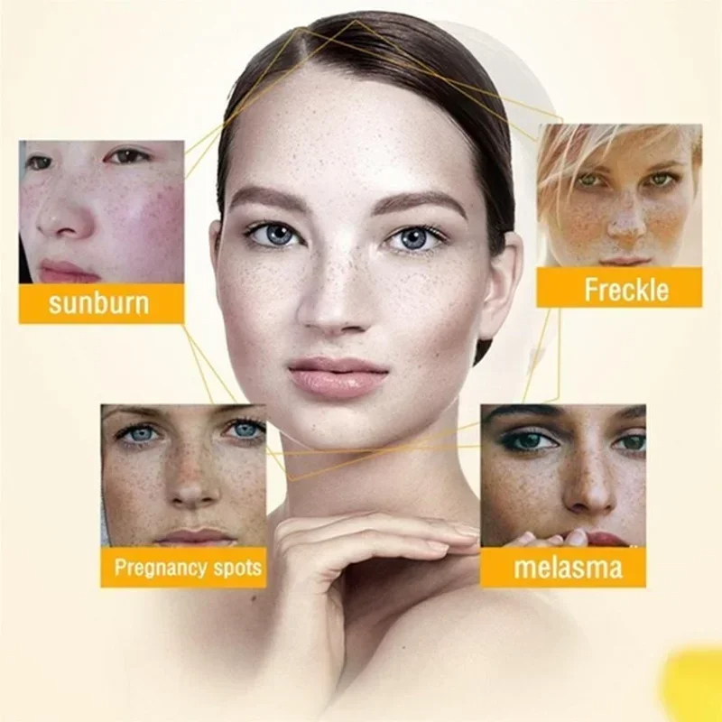 Remove Wrinkle Cream Retinol F - Retinol Anti Wrinkle Cream 评论和价格