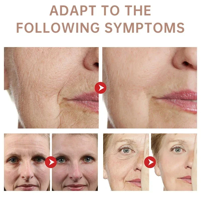 Remove Wrinkle Cream Retinol F - Retinol Anti Wrinkle Cream 评论和价格
