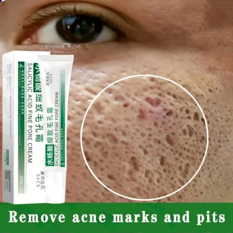Salicylic Acid Pore Clearing C - Salicylic Acid Blackhead Remover 评论和价格