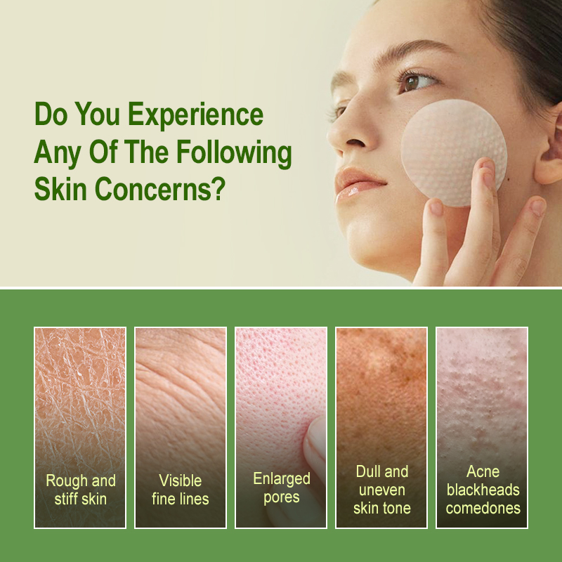 Salicylic Acid Exfoliating Pad - Salicylic Acid Blackhead Remover 评论和价格
