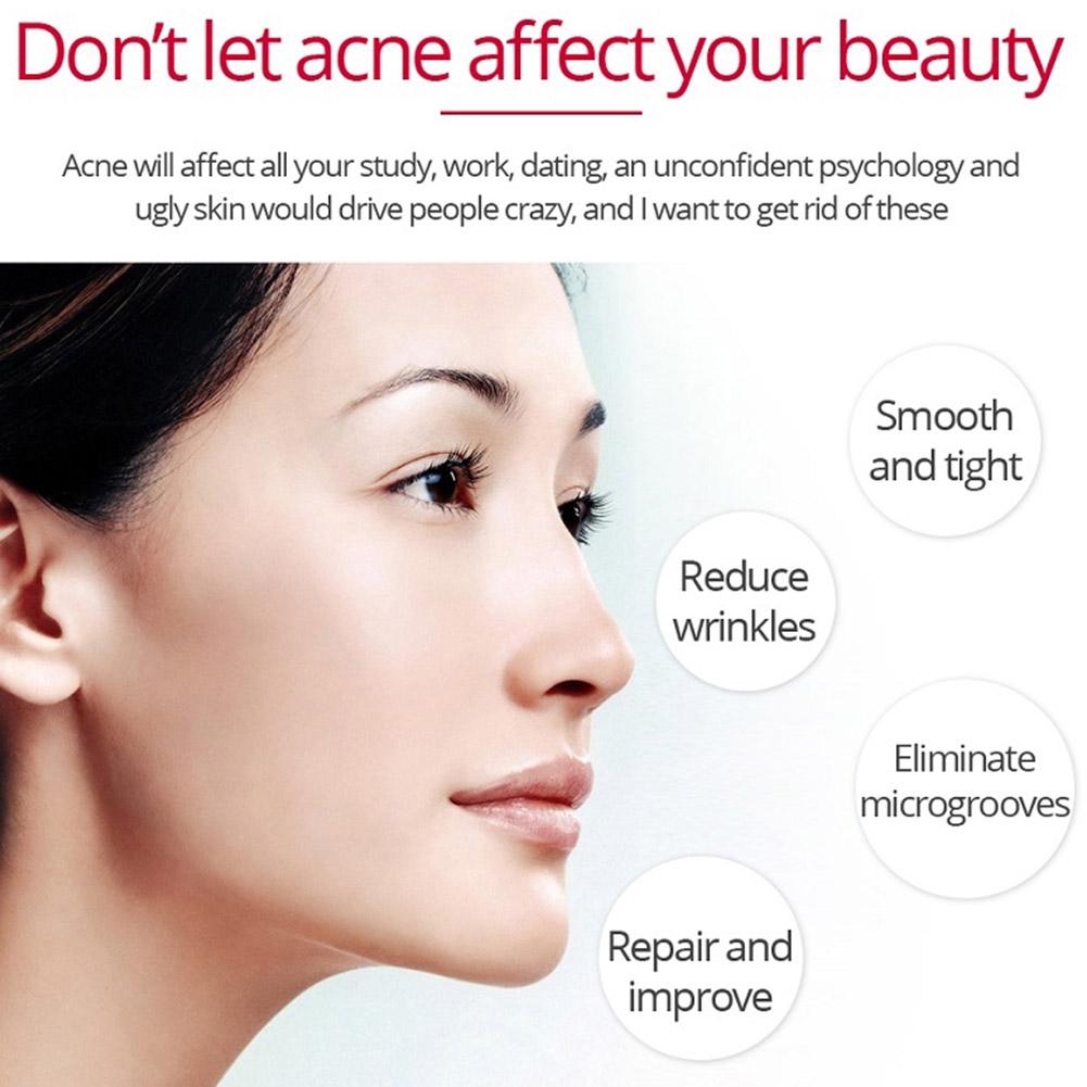 Retinol Lifting Firming Cream  - Retinol Anti Wrinkle Cream 评论和价格
