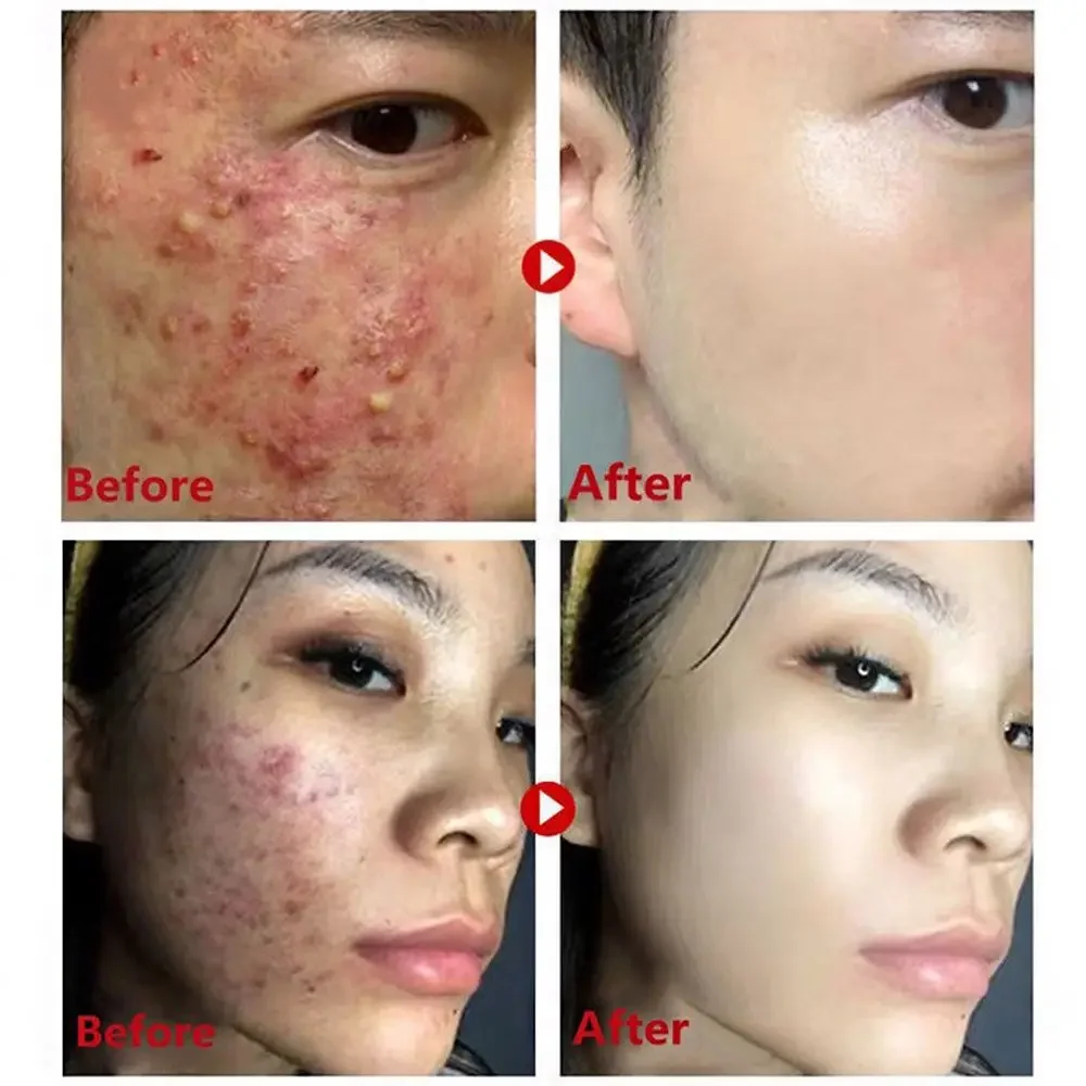 Green Tea Mask Stick Remove Bl - Green Tea Cleansing Clay Mask 评论和价格